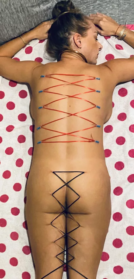 Playing with Needles by pyrrh0