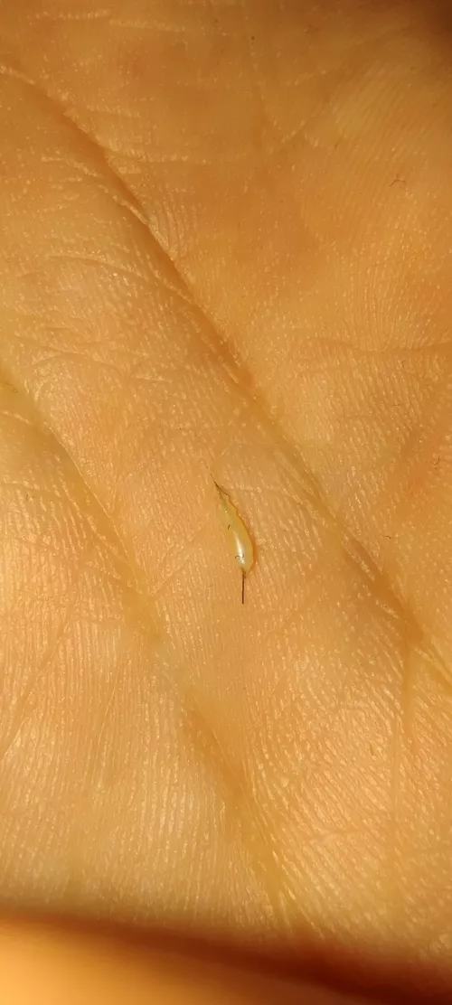 Popped this out of my labia. Tbh didn't expect anything to come out. by Teaa-