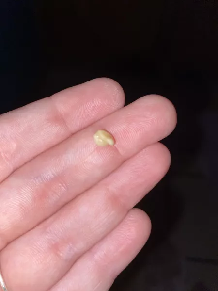 popped this out of my tonsil. i was so surprised!! the human body is crazy yall. i wish i got a video of it. my throat feels so much better by Commercial_Pin1909