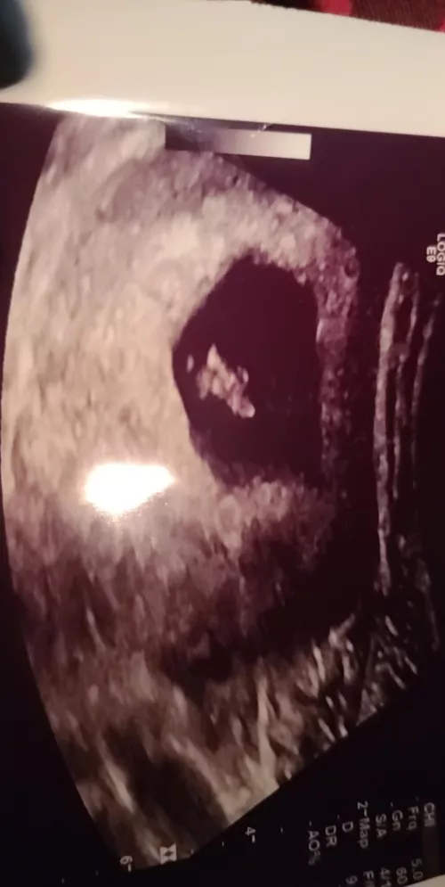 Positive Test at 11 days! Y'all get me my Whole Pregnancy this time! 7wks 4d by Cloudkitty55