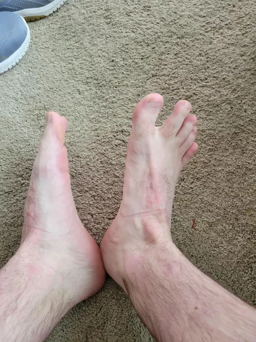 Post work out feet by Rugbyman5280