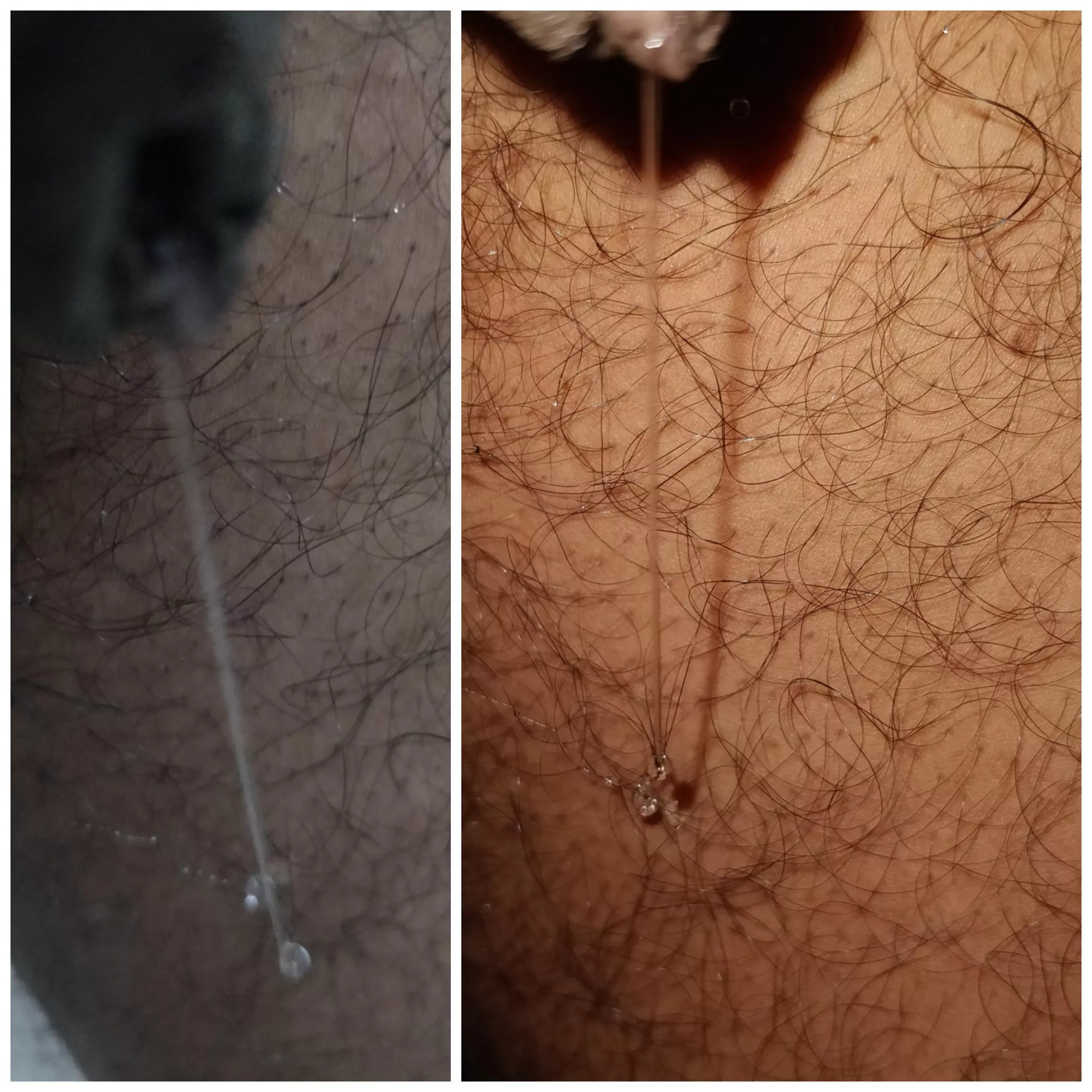 Precum dripping 💧💧💧-the diamond lines. Did anyone sees my tip🙈 posted by THE-HULK2020