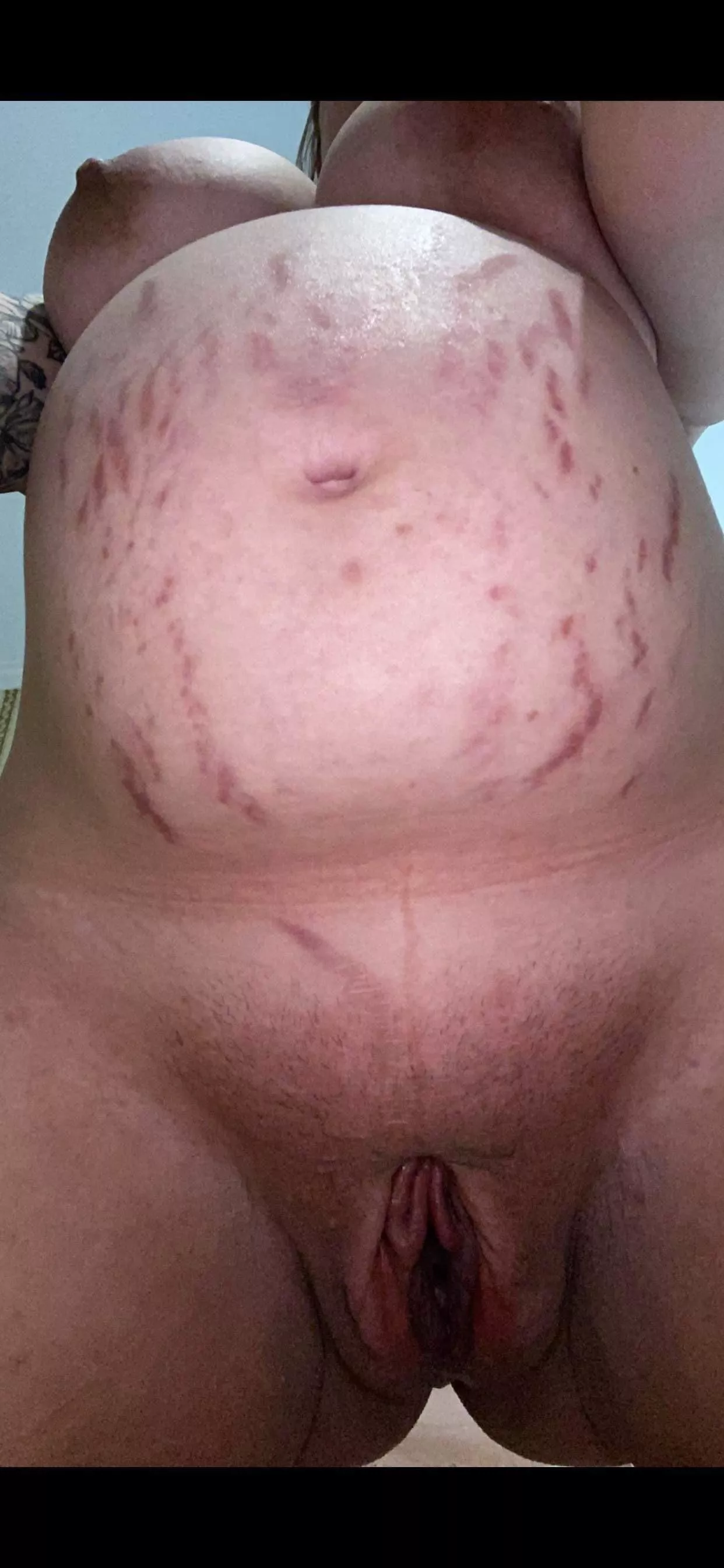 Pregnancy swell posted by flossy114