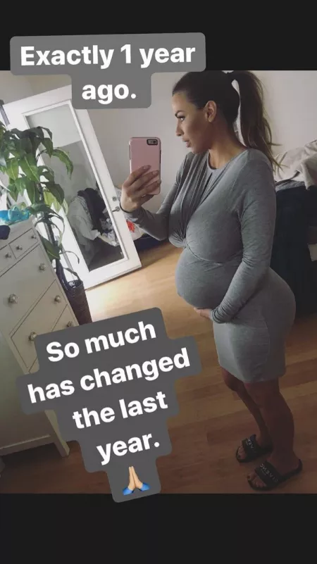 Pregnant - pre reduction by Cpc4171