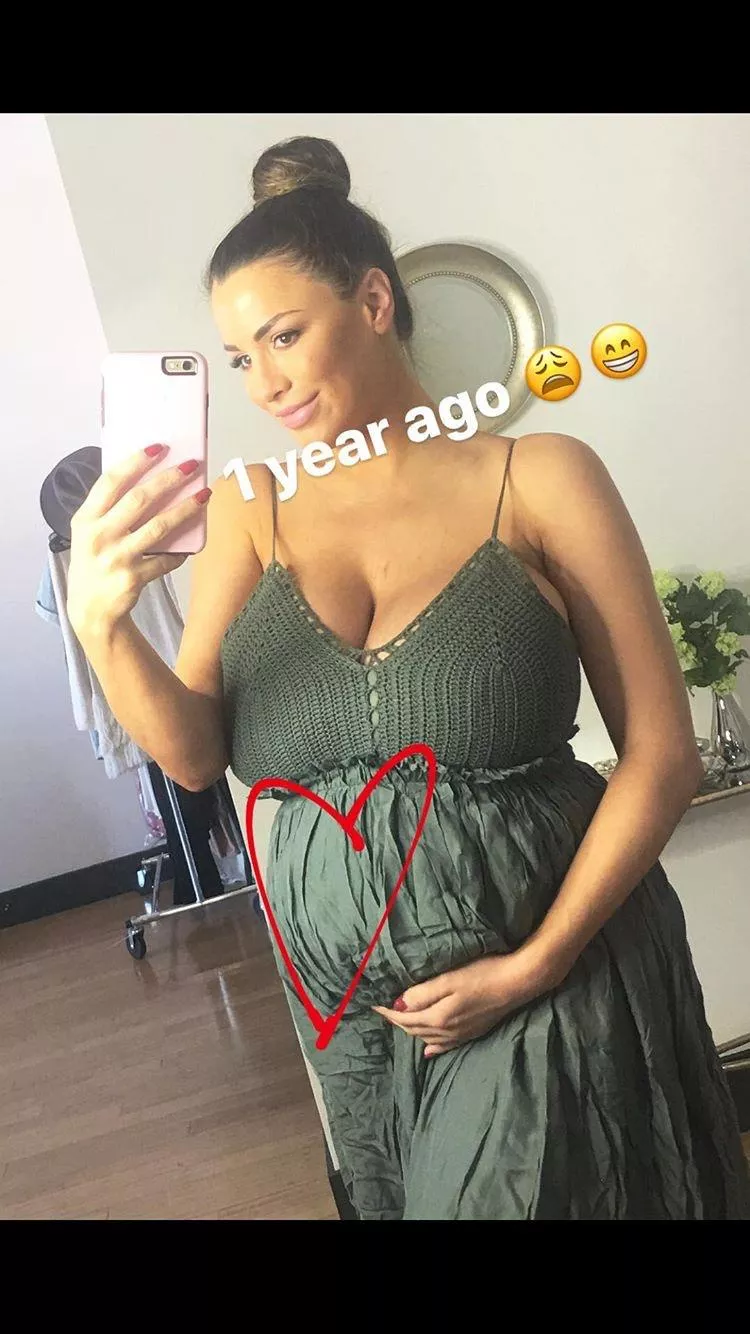 Pregnant - pre reduction posted by Cpc4171