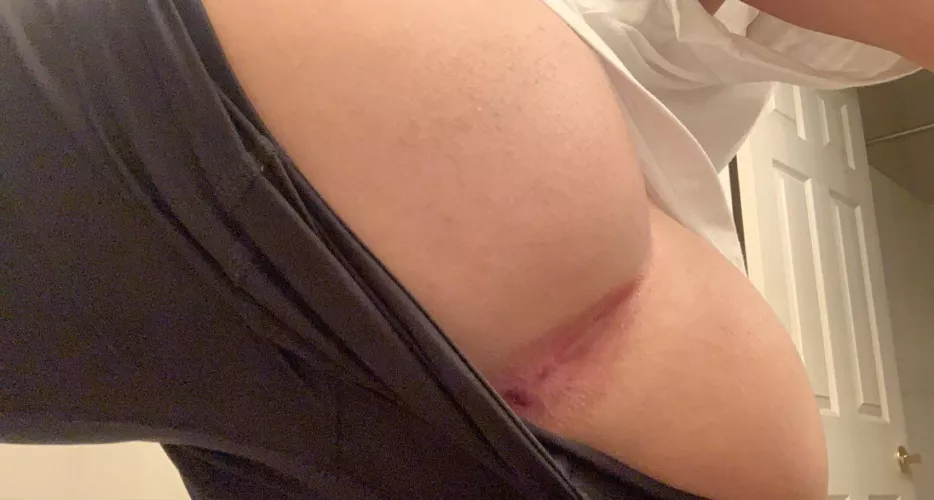 pretty pink hole by judas-0