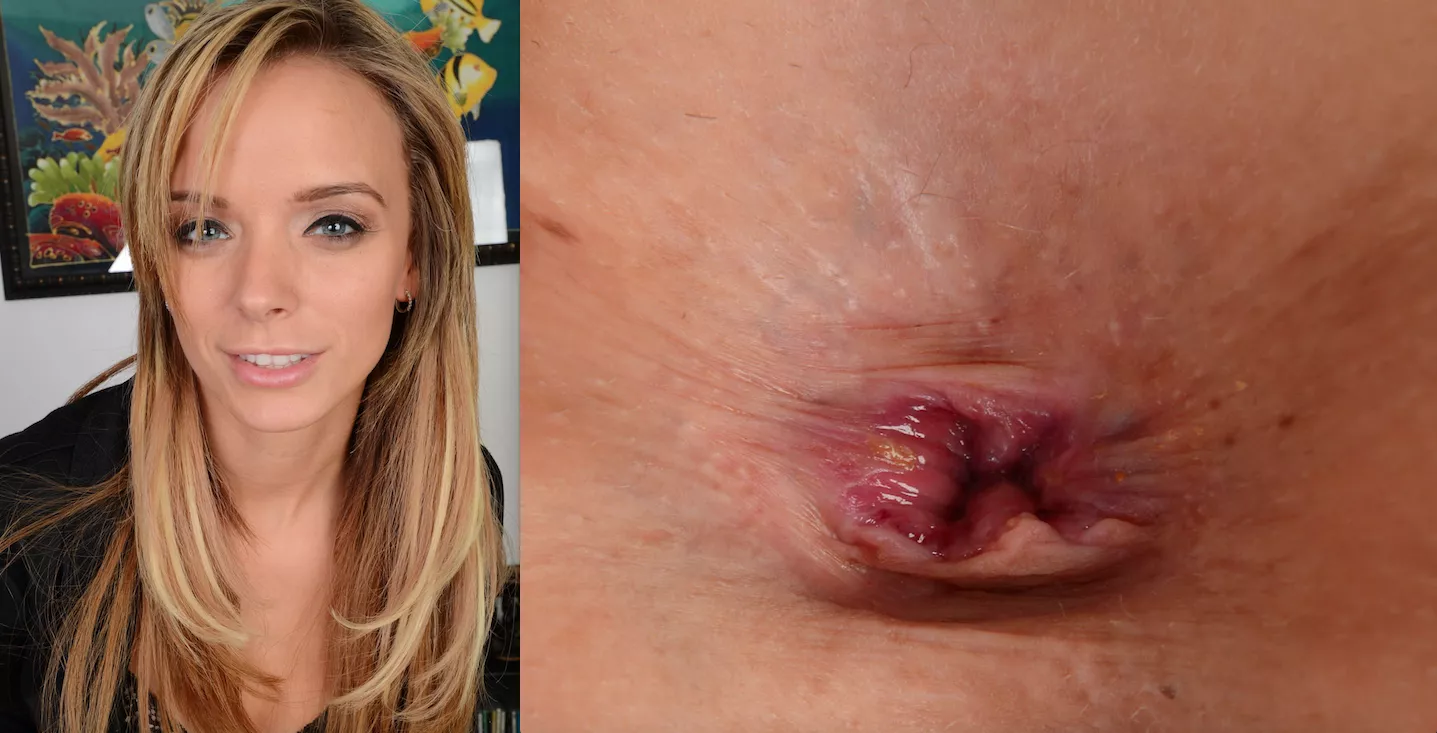 Pristine Edge's Asshole posted by alandoo