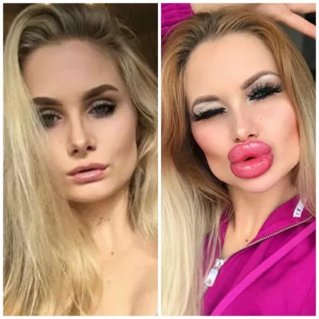 Probably should’ve chilled out on the cheeks/jawline, but her lips are perfect by Goony_McGoonerface