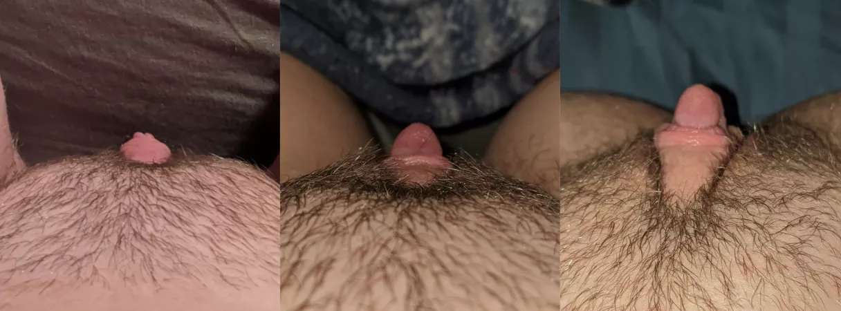 Progression of my clit growth~ 3 weeks on T, first time pumping, and last night after pumping~ by imhyperer