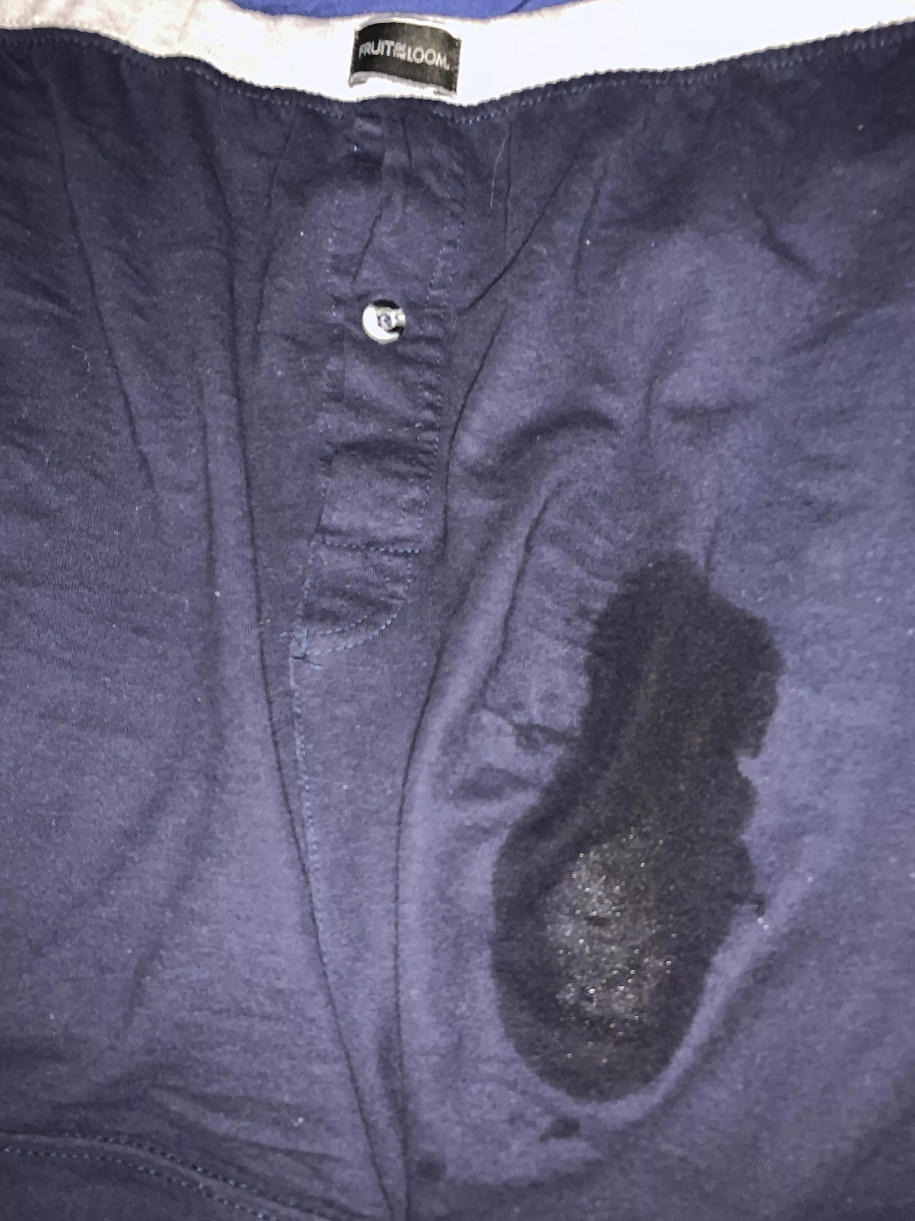 [proof] my precum over my boxers posted by [deleted]