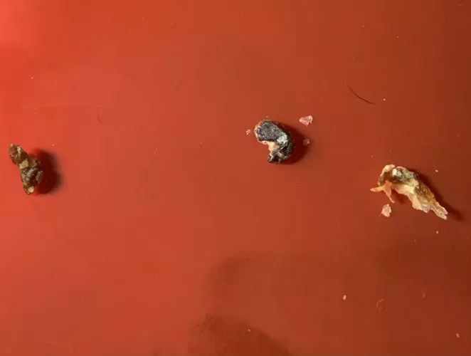 Pulled these out of my ears. by maplesyrupchin