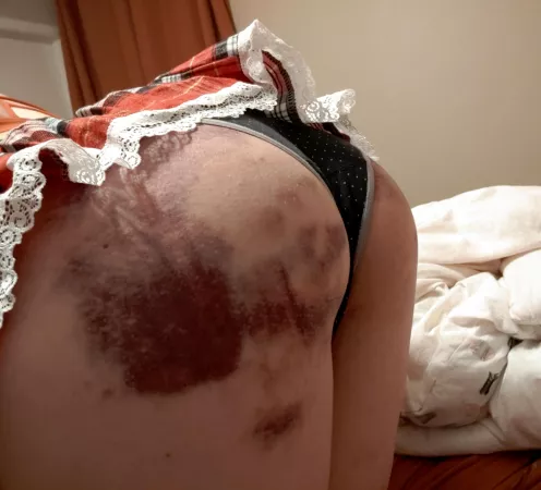 Punishment: [F] When your brat gives you a relaxing massage and SECRETLY puts a tattoo on your lower back! (Admittedly, I was proud/impressed with her scheme😈) by midnight_howler422