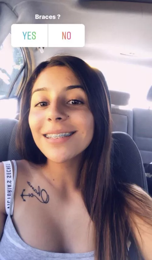 Put that big cock all over that brace face by pineapplexpress312