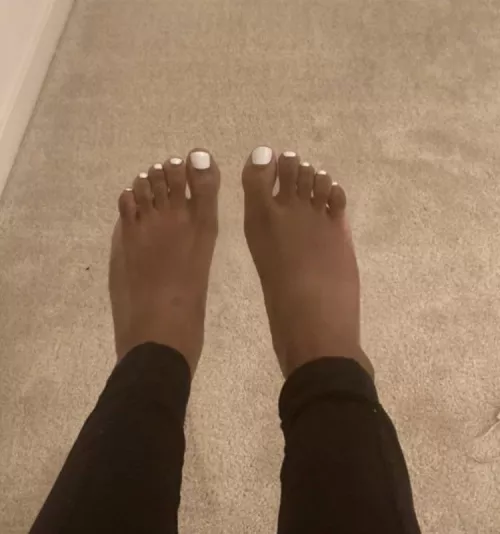 rate the white toes🥰 by NightProfessional605