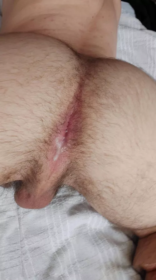 Ready for use by Aposox