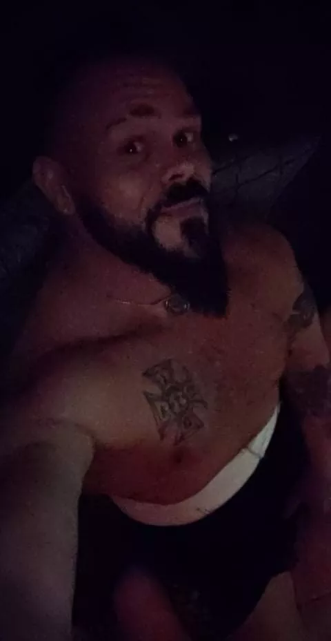 Recovery from surgery...any takers to kiss it and make it better? 😉😈 posted by teddybiggs