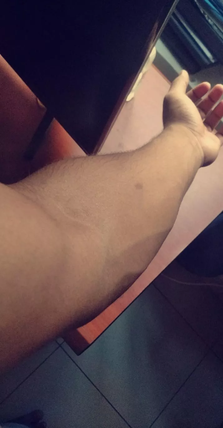 Relaxed forearm posted by MrGrizzlyyyyyy