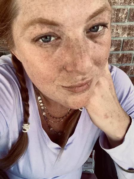 Remember to give your ginger five minutes of sunlight a day for maximum freckle effect. by Lisetta0810