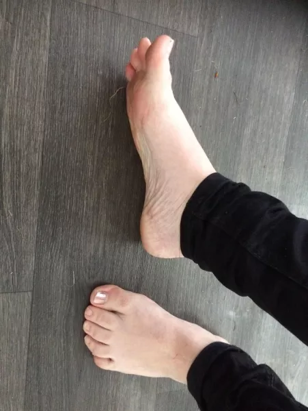 Requested pic, I think my toes are weird by 131277