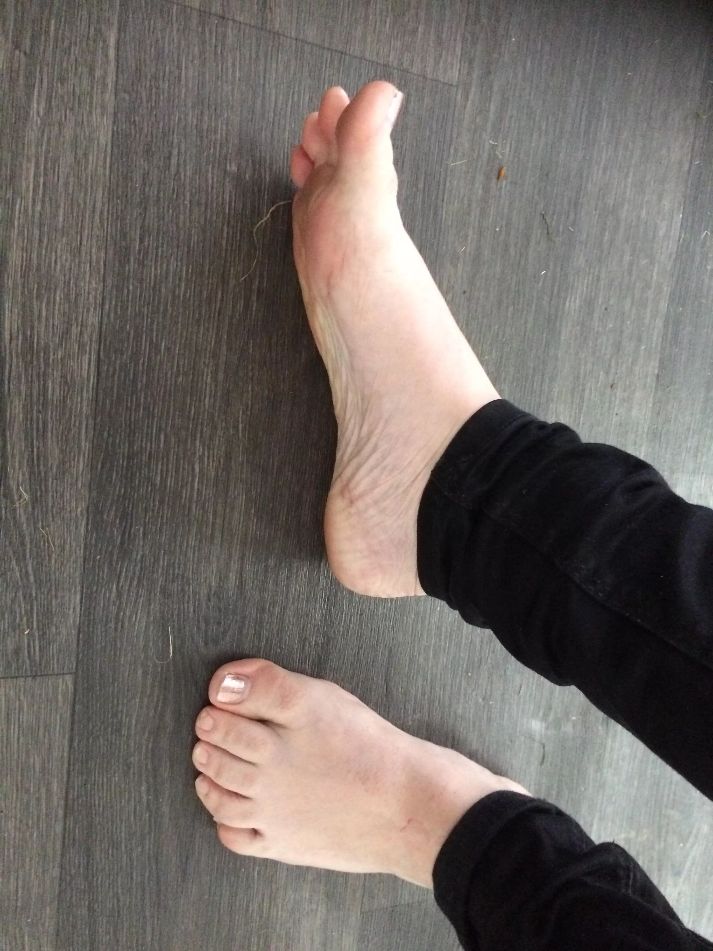 Requested pic, I think my toes are weird posted by 131277