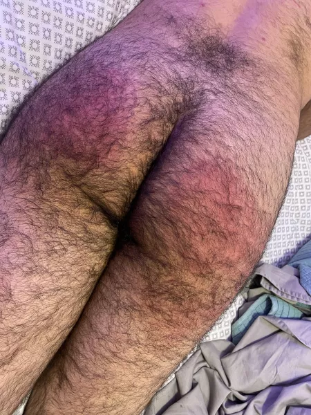 Results of a recent scene by thethrowaway48