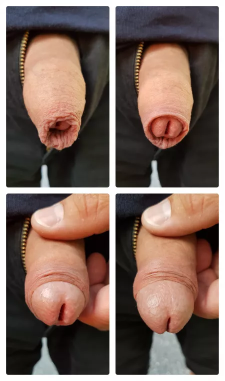 Reveal the head by ForeskinPeter