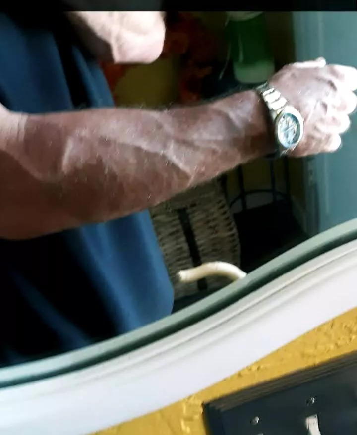 Right arm posted by nt011819