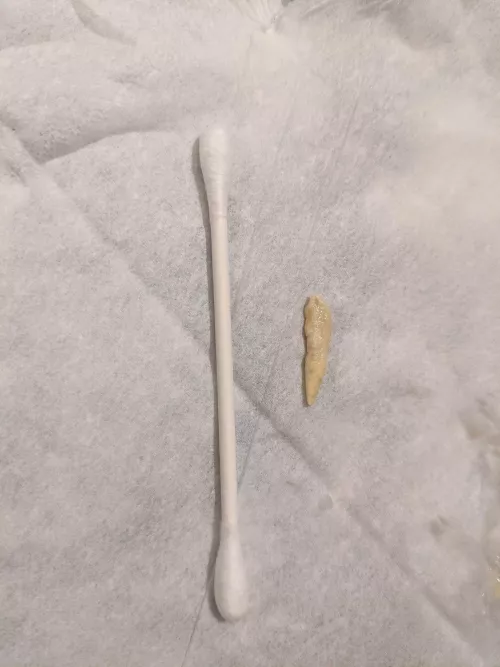 Right eye wasn't draining tears for almost 2 weeks. by Brnadon