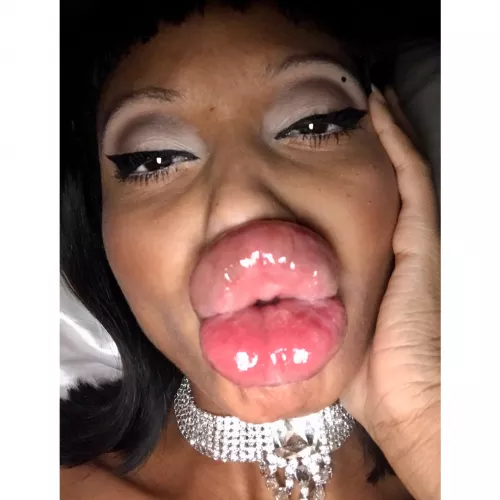 Ruby's GARGANTUAN LIPS!!! by Marathon1981