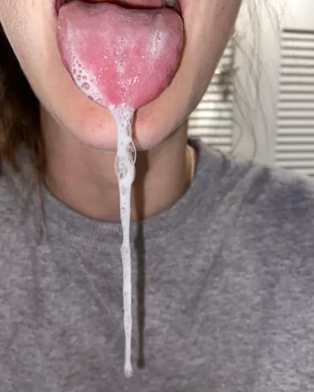 Say “ah”😮 by Creamyqueen669