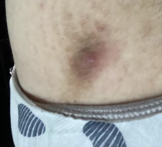 Say Hi To My Third Nipple! by leejasmin94