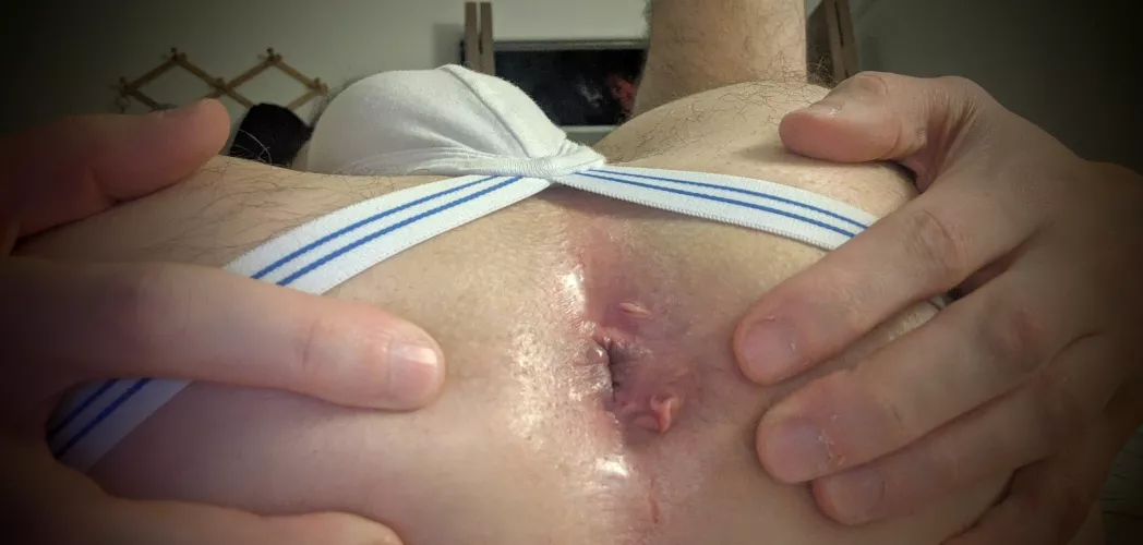 Self Conscious About Skin Tags. Okay or Gross? by JGBushido