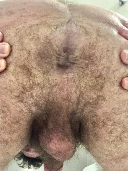 Sexted again with the 1st guy I chatted on snap. He asked to see my hole. Well I felt like sharing here too by [deleted]