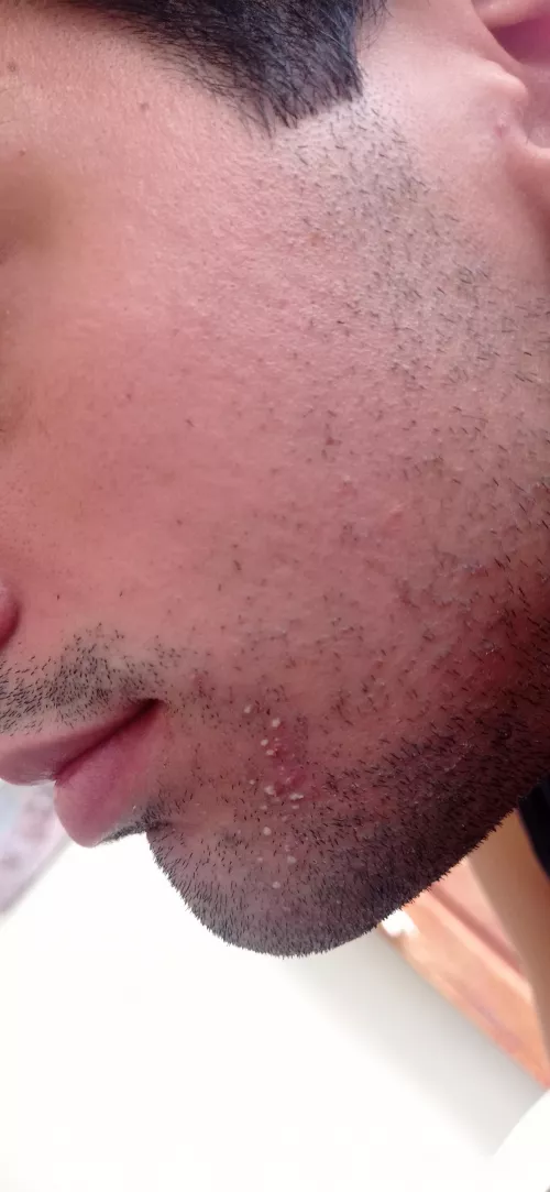 Shall i pop them all? by santy35