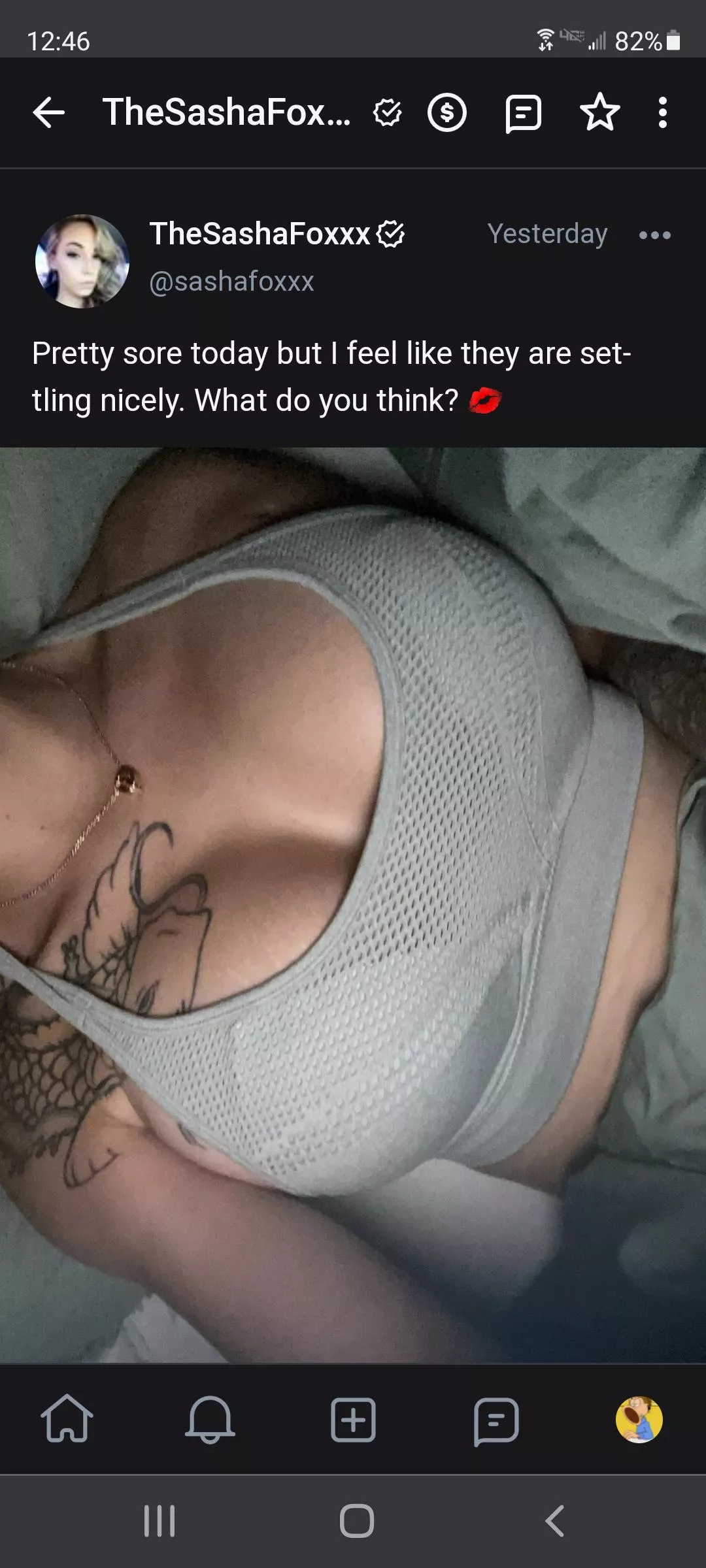 She had a boob job posted by barracudabear22