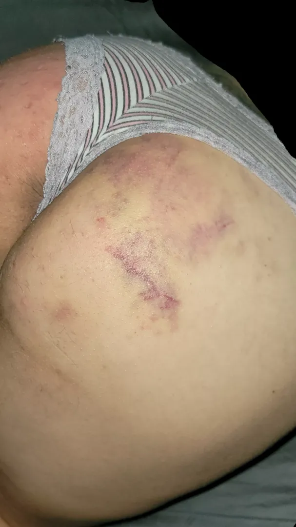 She Wears My Marks So Beautifully posted by JeddySpanks