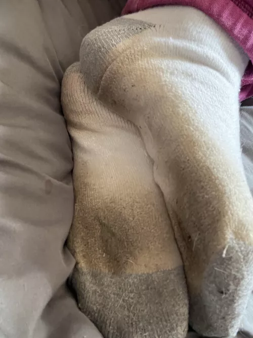 🤢 shit be so rank I have to wear clean socks over them to get in bed 👃 🧦🤢🤢🤢 by Snugglebug22