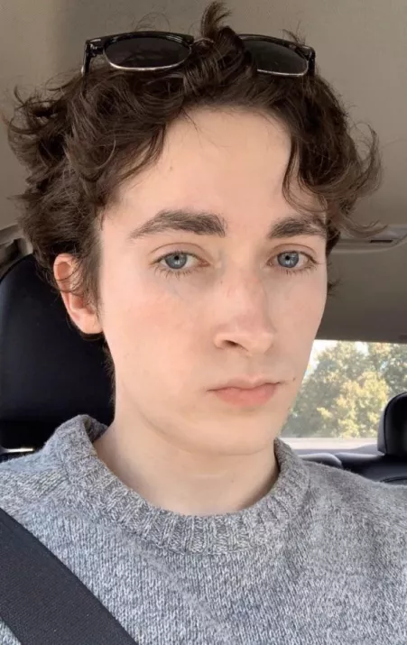 showing off my giant forehead XD by Call_Me_Carter