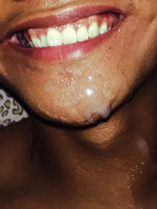 Since I've got no one to give me a good facial, I did it myself. Maybe you can do it next time? by Specialist-Emu4323