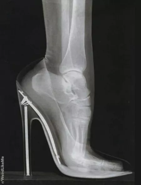 Sky high. by Familiar_Big3322