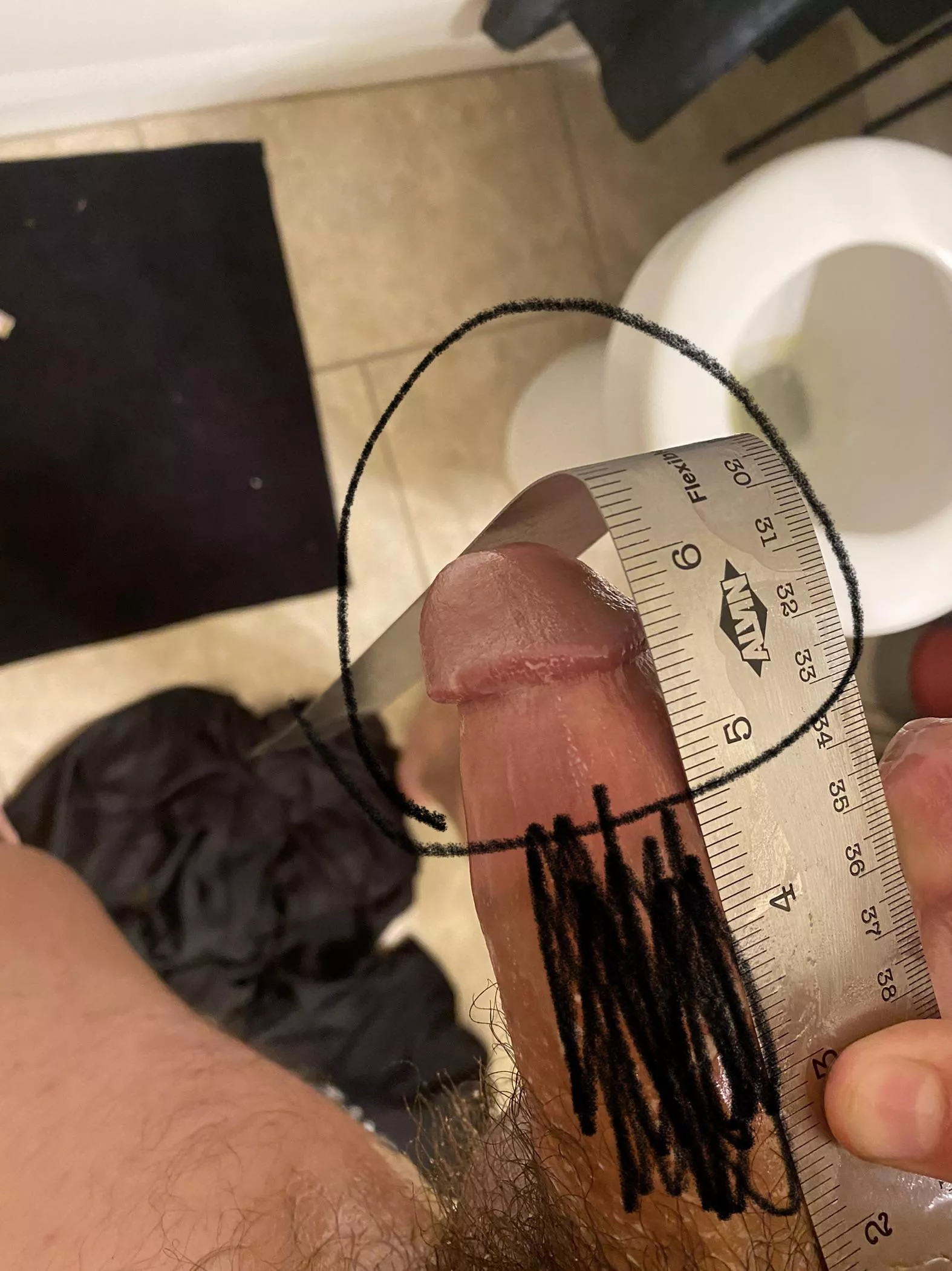 so do i correct this by using a tape? posted by KyloZaWarudo