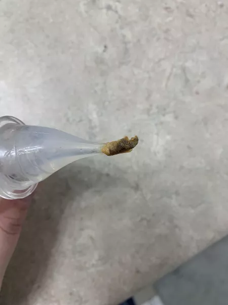 So I was irrigating my ears and this hooked on! by caecelius