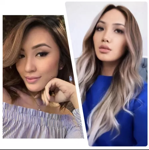 So much has changed this year for the better. Lip fillers, round 3, keyhole or no keyhole? by xoxoskylightxoxo