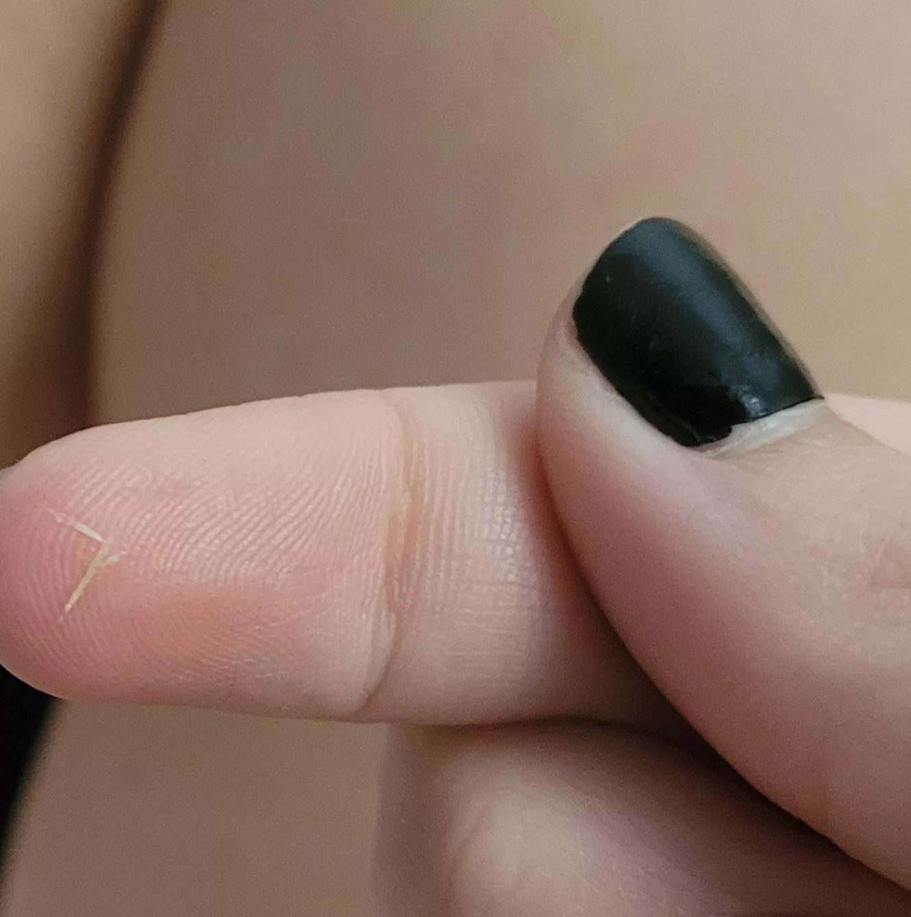 Some cool keratinized hair things I like to pull out of my sides. Any idea what they are or how they happen? posted by eward2278