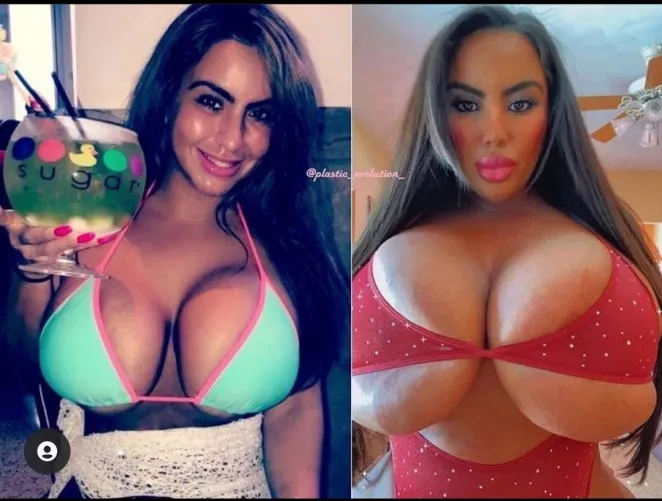 Some definite improvements by molsam69