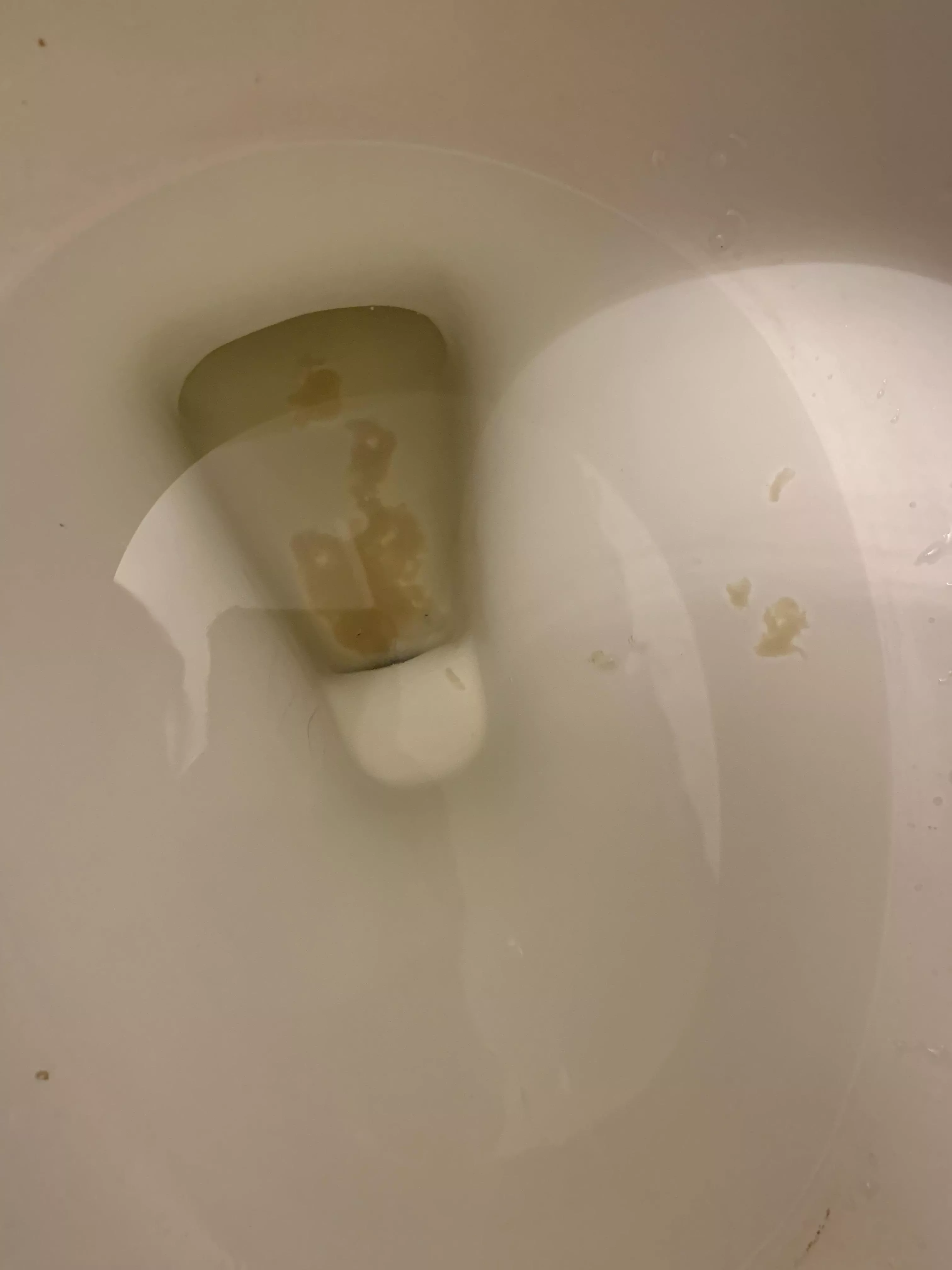 Something weird coming out of me after an enema?... what is it?!? posted by farlowtheleader