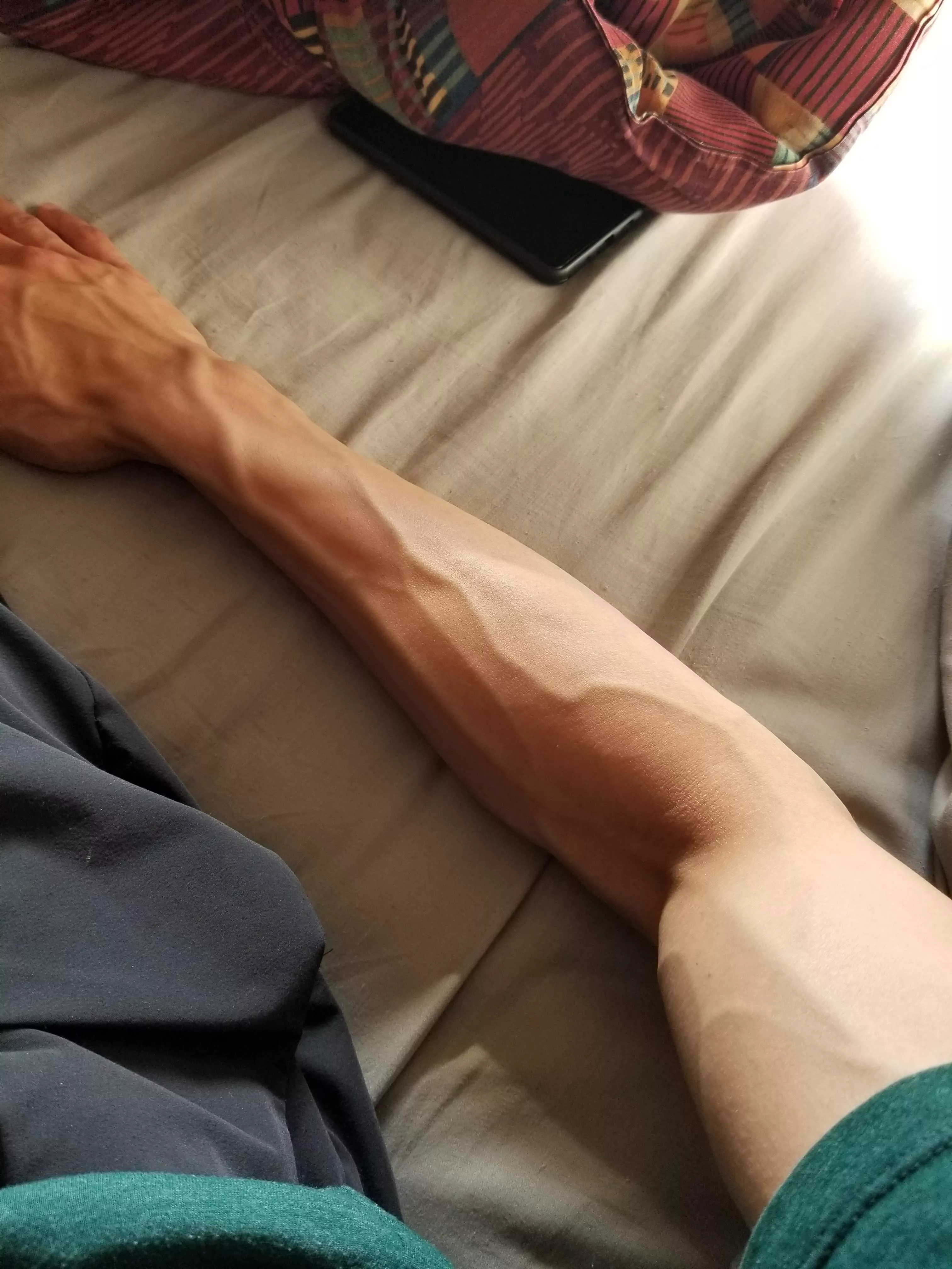 Sometimes it feels like my arms are going to explode posted by housingforu