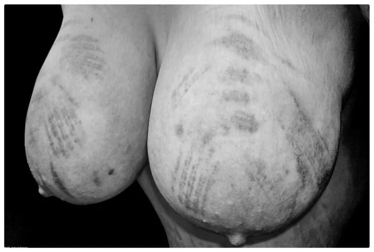 Sore juggs by sunnymirte