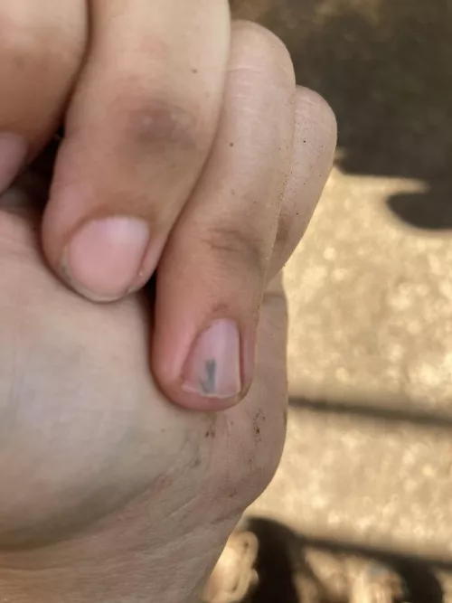 Sorry about the dirty hands. Just finished work. Think I can get this splinter out on my own? by shine-notburn