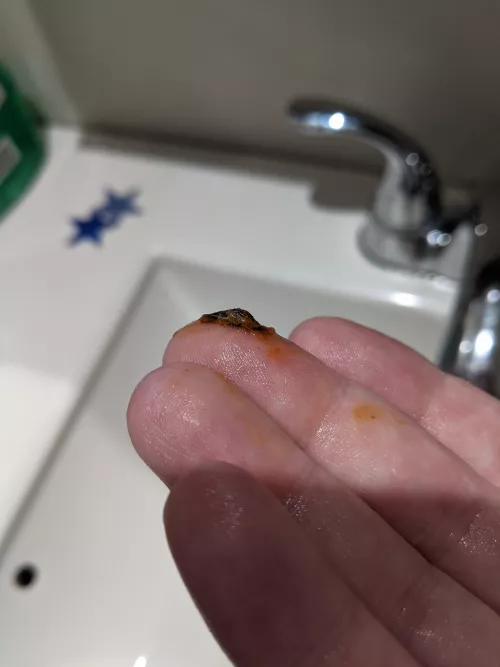 Sounded like paper in my ear. Hydrogen peroxide and flushing with a suction bulb got this beauty out by Kansai_Lai